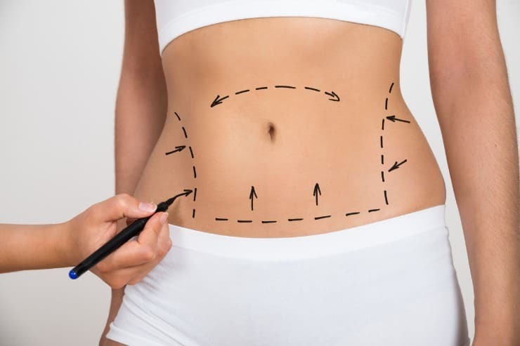 Implante de silicone, lipoaspiração, abdominoplastia ou rinoplastia: qual cirurgia é a ideal pra mim?